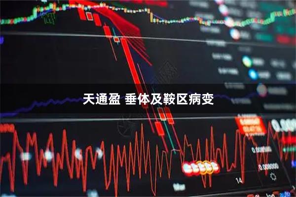 天通盈 垂体及鞍区病变